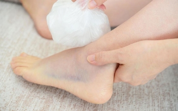 CÁCH XỬ LÝ KHI BỊ BONG GÂN
